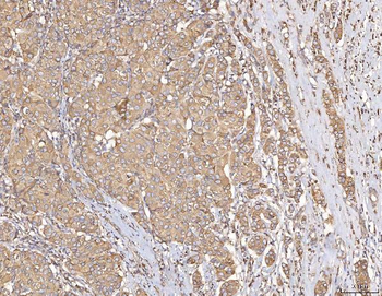 Calmegin/CLGN Rabbit Polyclonal Antibody