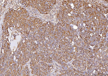 Calmegin/CLGN Rabbit Polyclonal Antibody