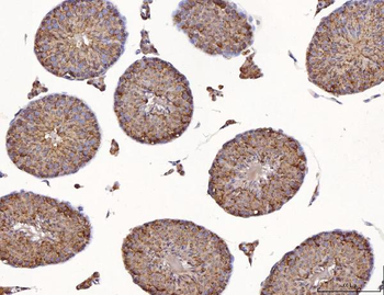 Calmegin/CLGN Rabbit Polyclonal Antibody