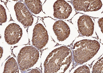 Calmegin/CLGN Rabbit Polyclonal Antibody