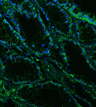 Claudin18/CLDN18 Rabbit Polyclonal Antibody