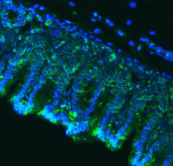 Claudin18/CLDN18 Rabbit Polyclonal Antibody