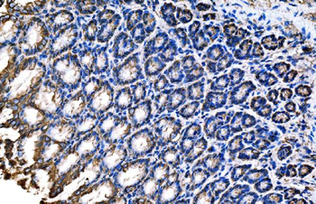 Claudin18/CLDN18 Rabbit Polyclonal Antibody