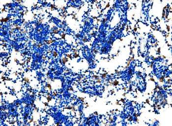Cd27 Rabbit Polyclonal Antibody