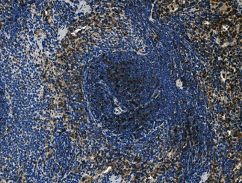 Cd4 Rabbit Polyclonal Antibody