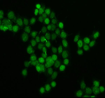 BRD4 Rabbit Polyclonal Antibody