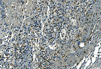 Azurocidin/AZU1 Rabbit Polyclonal Antibody