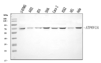 ATP6V1A Rabbit Polyclonal Antibody