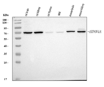 ATP6V1A Rabbit Polyclonal Antibody