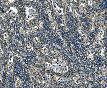 ATP6V1A Rabbit Polyclonal Antibody