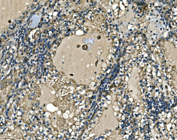 ATP6V1A Rabbit Polyclonal Antibody