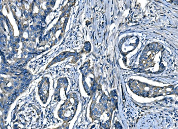 SPG3A/ATL1 Rabbit Polyclonal Antibody