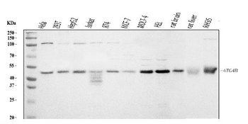 ATG4B Rabbit Polyclonal Antibody