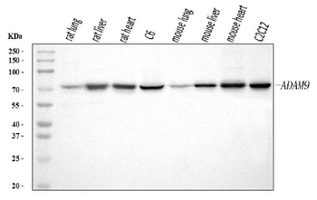 ADAM9 Rabbit Polyclonal Antibody