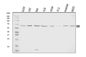 Vitamin D Receptor/VDR Antibody