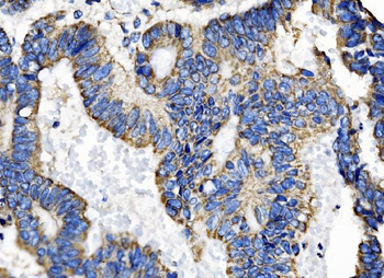 TOMM70 Rabbit Polyclonal Antibody
