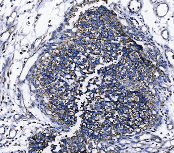 TOMM70 Rabbit Polyclonal Antibody