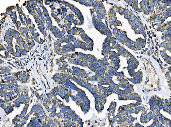 TOMM70 Rabbit Polyclonal Antibody