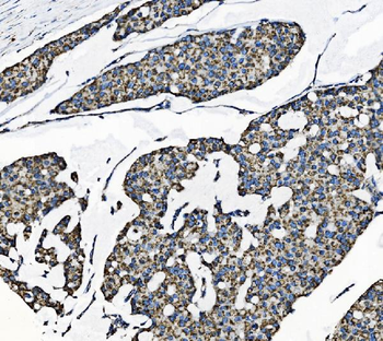 TOMM70 Rabbit Polyclonal Antibody