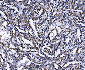 TOMM70 Rabbit Polyclonal Antibody