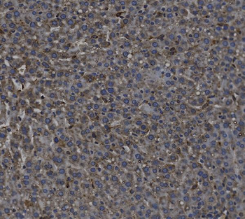 TGF beta 1/TGFB1 Antibody