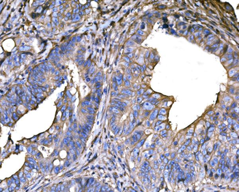 SNAP23 Rabbit Polyclonal Antibody