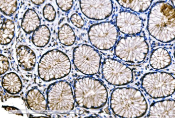 SNAP23 Rabbit Polyclonal Antibody