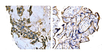 SNAP23 Rabbit Polyclonal Antibody
