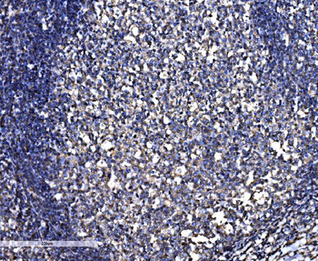 SNAP23 Rabbit Polyclonal Antibody