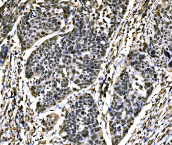 SnoN/SNO/SKIL Antibody