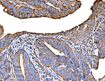 RPL32 Rabbit Polyclonal Antibody