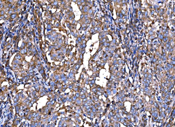 RPL32 Rabbit Polyclonal Antibody