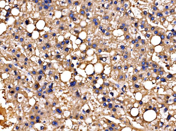PPFIA1 Antibody