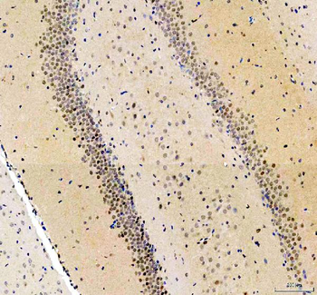 p38 alpha/MAPK14 Rabbit Polyclonal Antibody