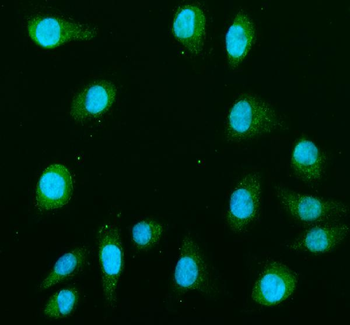 MEK1/MAP2K1 Rabbit Polyclonal Antibody