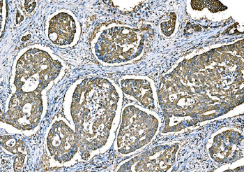 Ezrin/EZR Rabbit Polyclonal Antibody