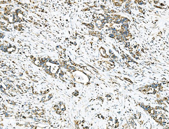 Ezrin/EZR Rabbit Polyclonal Antibody