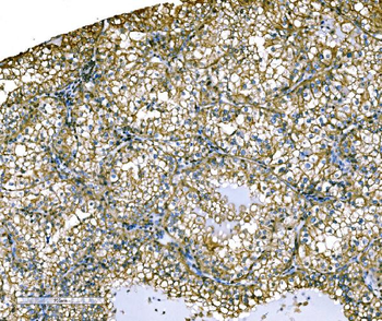 Ezrin/EZR Rabbit Polyclonal Antibody