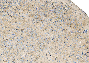 Ezrin/EZR Rabbit Polyclonal Antibody