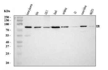 Ezrin/EZR Rabbit Polyclonal Antibody