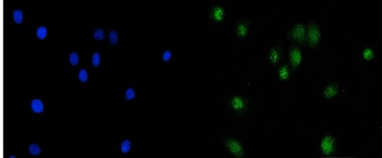 KAT3B/p300/EP300 Antibody