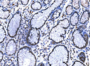 KAT3B/p300/EP300 Antibody