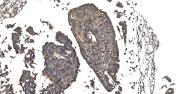 Elongin-C/ELOC Rabbit Polyclonal Antibody