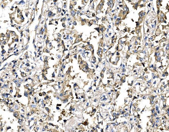 Elongin-C/ELOC Rabbit Polyclonal Antibody