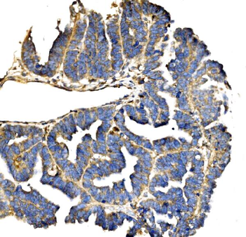 Elongin-C/ELOC Rabbit Polyclonal Antibody