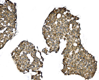 Elongin-C/ELOC Rabbit Polyclonal Antibody