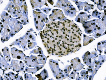 TCEB2/Elongin-B/ELOB Rabbit Polyclonal Antibody