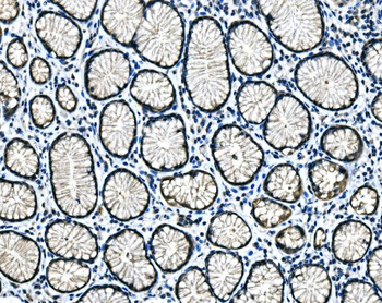 Hsp40/DNAJB1 Antibody