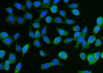 DCP1A Rabbit Polyclonal Antibody