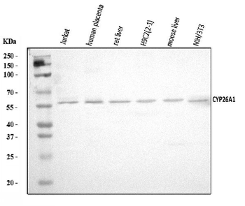 CYP26A1 Rabbit Polyclonal Antibody